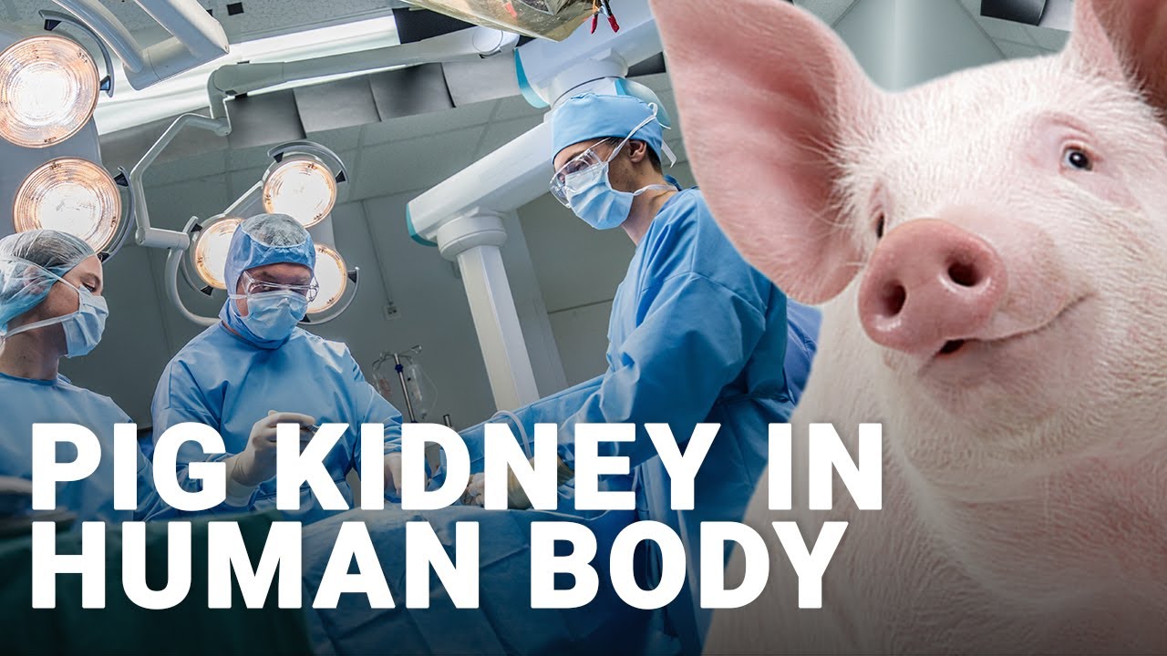 Pig Kidney's Revolution of AnimalHuman Transplants